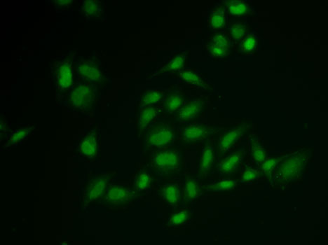 Anti-SSRP1 Antibody (CAB6413)