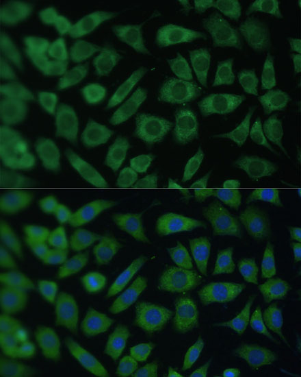 Anti-ARL3 Antibody (CAB16348)