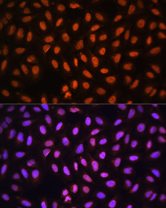 Anti-MCM5 Antibody (CAB13514)