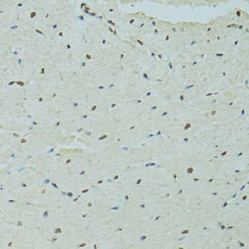 Anti-SAFB Antibody (CAB7927)