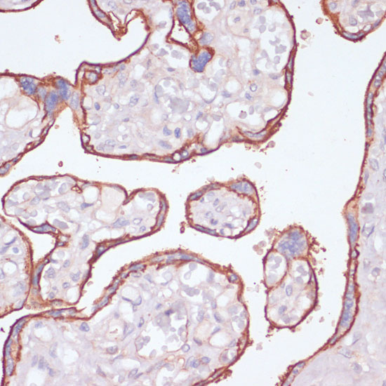 Anti-NT5E / CD73 Antibody [KO Validated] (CAB2029)