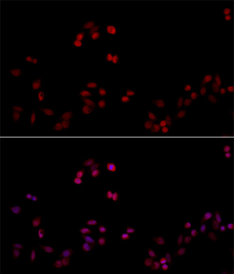 Anti-PCNA Antibody (CAB0264)