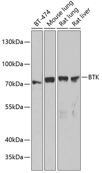 Anti-BTK Antibody (CAB12738)