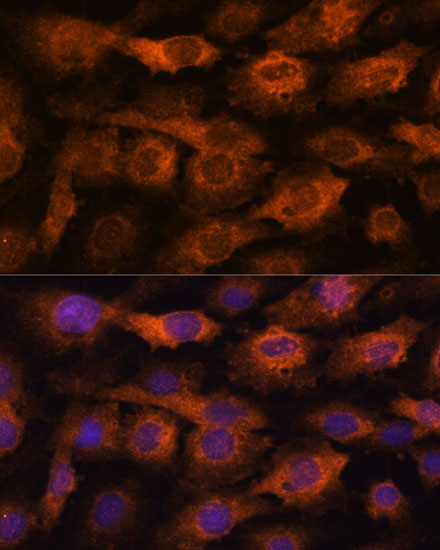 Anti-IFITM3 Antibody [KO Validated] (CAB13070)