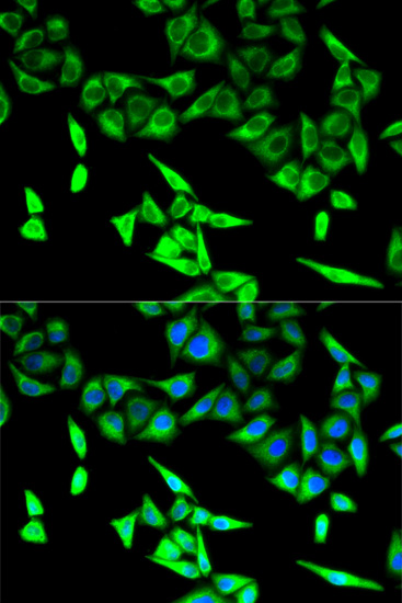 Anti-HADHA Antibody [KO Validated] (CAB5346)