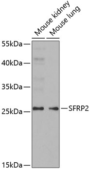 Anti-SFRP2 Antibody (CAB5383)