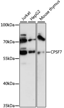 Anti-FLJ12529 Antibody (CAB13880)