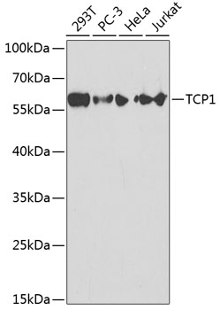 Anti-TCP1 Antibody (CAB1950)