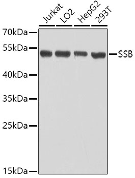 Anti-SSB Antibody (CAB0630)