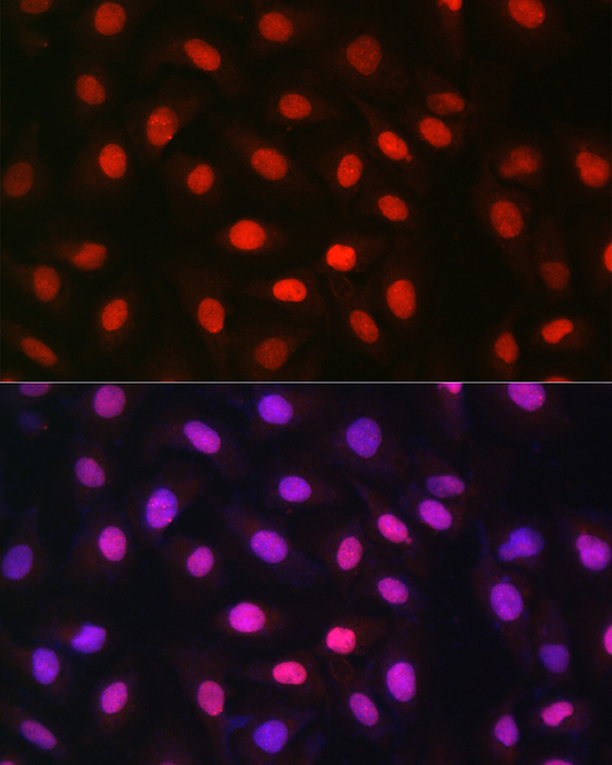 Anti-MDC1 Antibody (CAB12714)