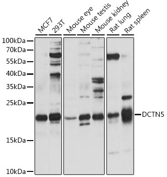 Anti-DCTN5 Antibody (CAB15915)