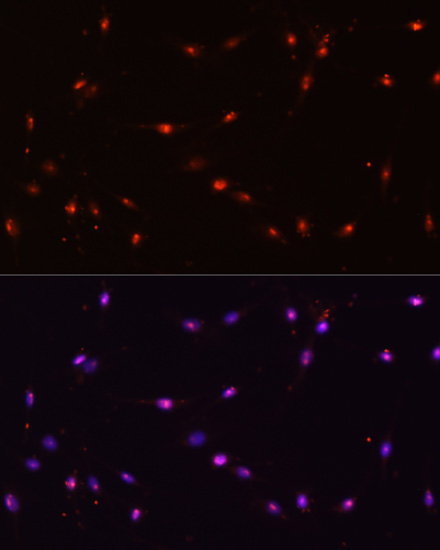 Anti-ILF3 Antibody (CAB2496)