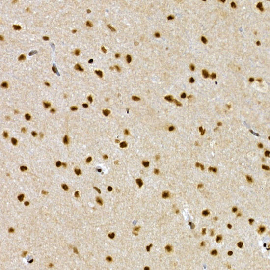 Immunohistochemistry of paraffin-embedded rat brain using SCAF4 Rabbit pAb at dilution of 1:50 (40x lens). Perform high pressure antigen retrieval with 10 mM citrate buffer pH 6. 0 before commencing with IHC staining protocol.