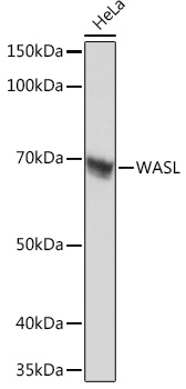 Anti-WASL Antibody (CAB2270)