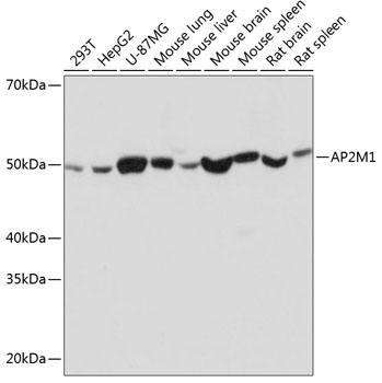 Anti-AP2M1 Antibody