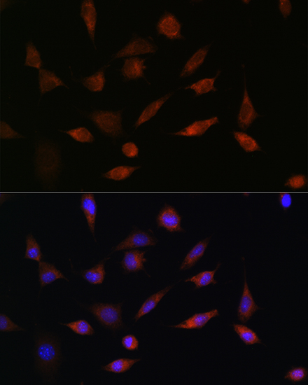 Anti-PDCD5 Antibody (CAB7298)