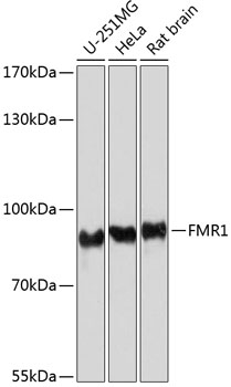 Anti-FMR1 Antibody (CAB6092)