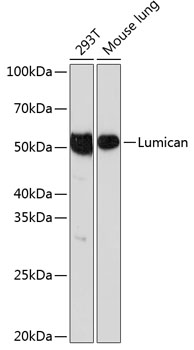 Anti-Lumican Antibody