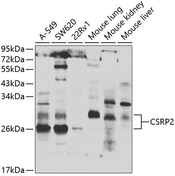 Anti-CSRP2 Antibody (CAB7549)