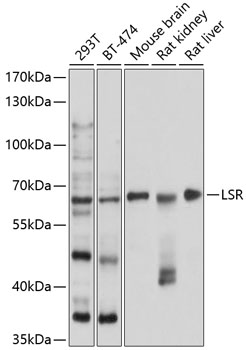 Anti-LSR Polyclonal Antibody (CAB9340)