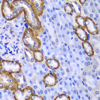 Anti-MYO1C Antibody (CAB6936)