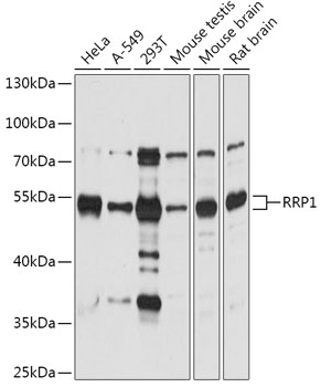 Anti-RRP1 Antibody (CAB17569)