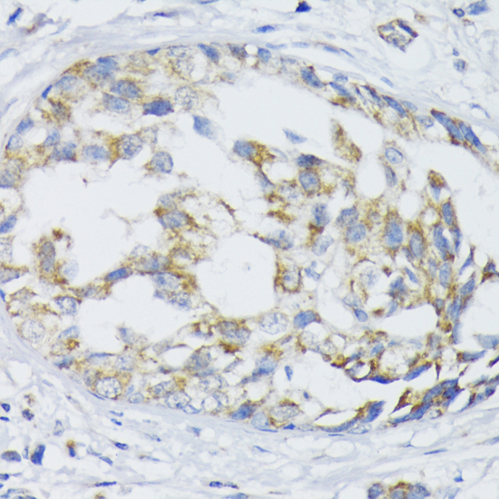 Anti-SLC30A1 Antibody (CAB12532)