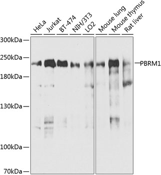 Anti-Protein polybromo-1 Polyclonal Antibody (CAB9878)