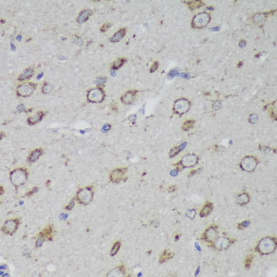 Anti-PSAP Antibody (CAB1819)