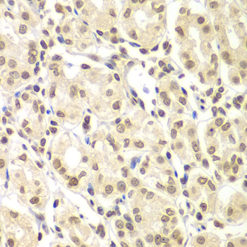 Anti-ULK4 Antibody (CAB7471)