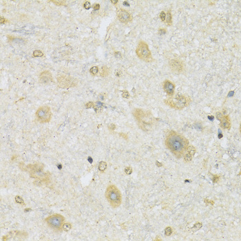 Anti-SLC2A13 Polyclonal Antibody (CAB9993)