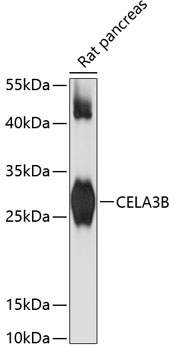 Anti-CELA3B Antibody (CAB13714)