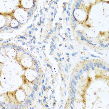 Anti-NTF4 Antibody (CAB0912)