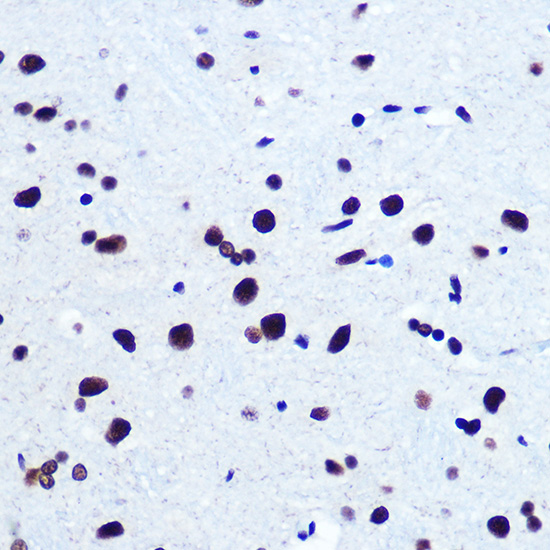 Anti-SRF Antibody (CAB7731)