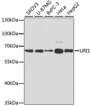 Anti-URI1 Antibody