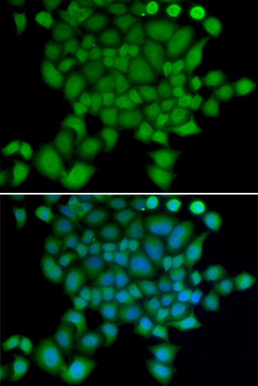 Anti-NEDD9 Antibody (CAB2521)