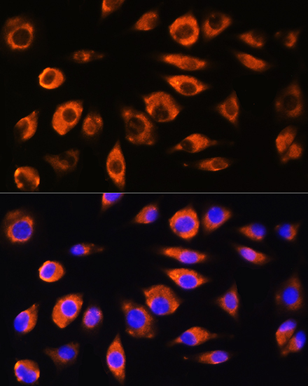 Anti-ADAM9 Antibody (CAB5388)