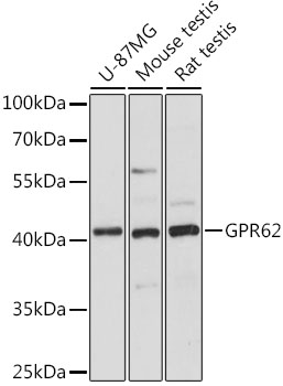 Anti-GPR62 Antibody (CAB16163)