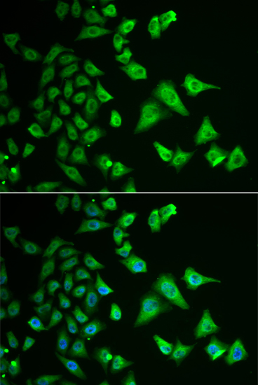 Anti-DHRS2 Antibody (CAB6446)