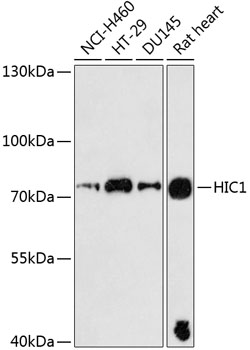 Anti-HIC1 Polyclonal Antibody (CAB9651)