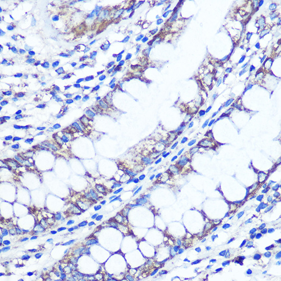 Anti-LC3B Antibody (CAB5601)