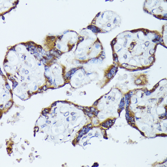 Anti-TBCB Antibody (CAB13248)