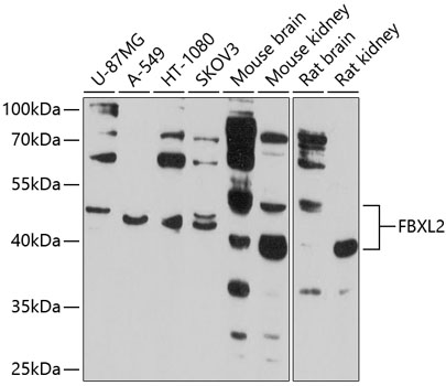 Anti-FBXL2 Antibody (CAB10296)