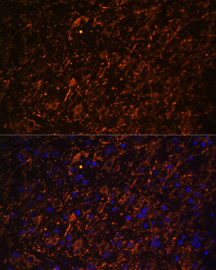 Anti-Map2 Antibody (CAB17409)