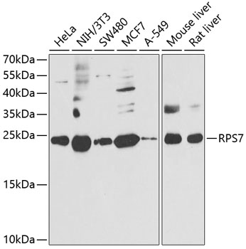 Anti-RPS7 Antibody (CAB6731)