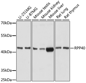 Anti-RPP40 Antibody (CAB17086)