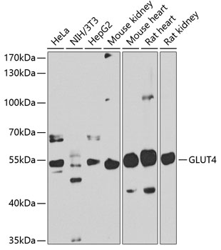 Anti-GLUT4 Antibody (CAB7637)