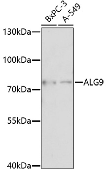 Anti-ALG9 Antibody (CAB17213)