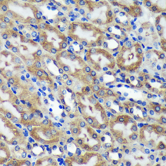 Anti-C18orf8 Antibody (CAB15825)