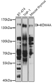 Anti-KDM4A Polyclonal Antibody (CAB7953)